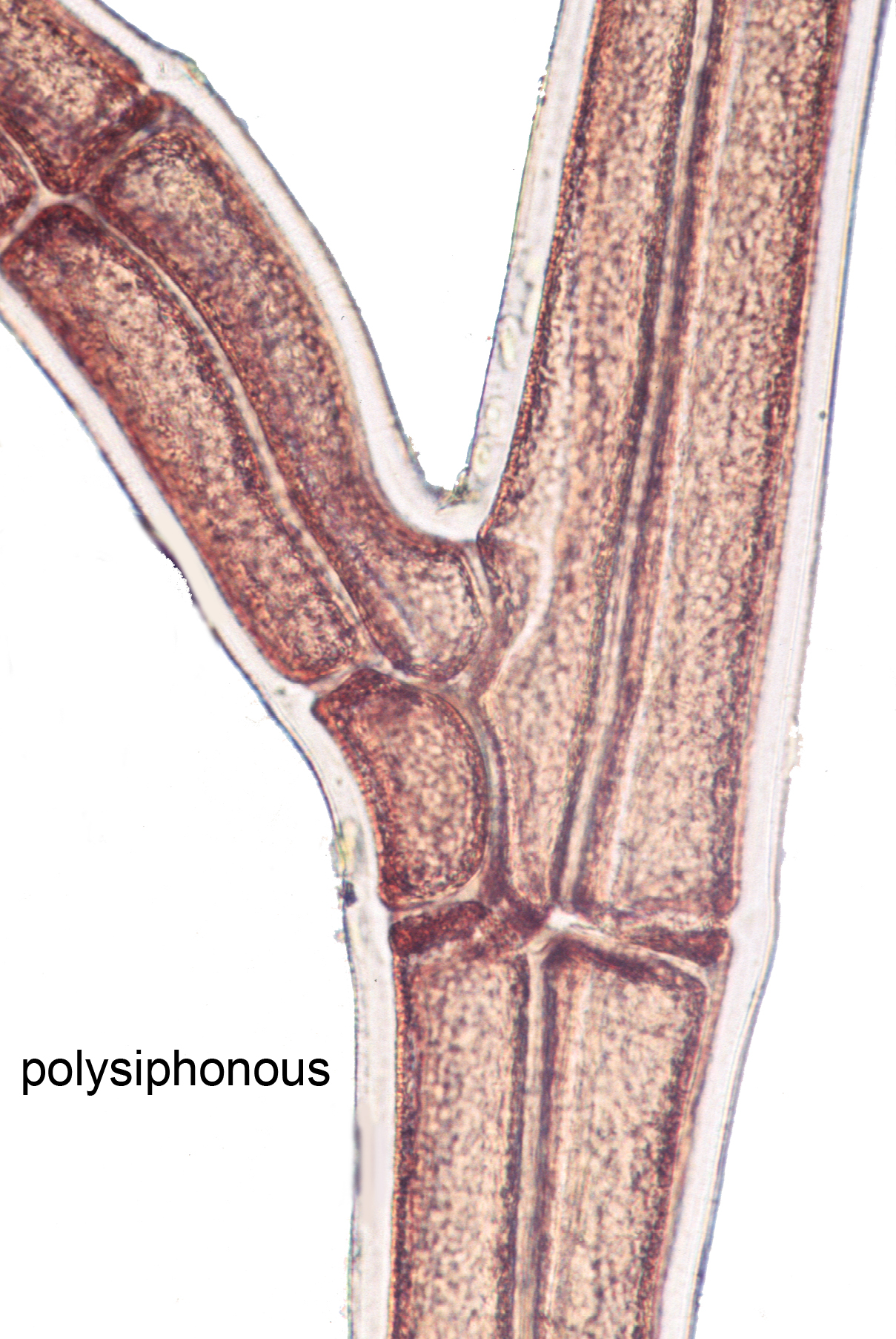 Polysiphonia pacifica var. pacifica – M. Lindeberg