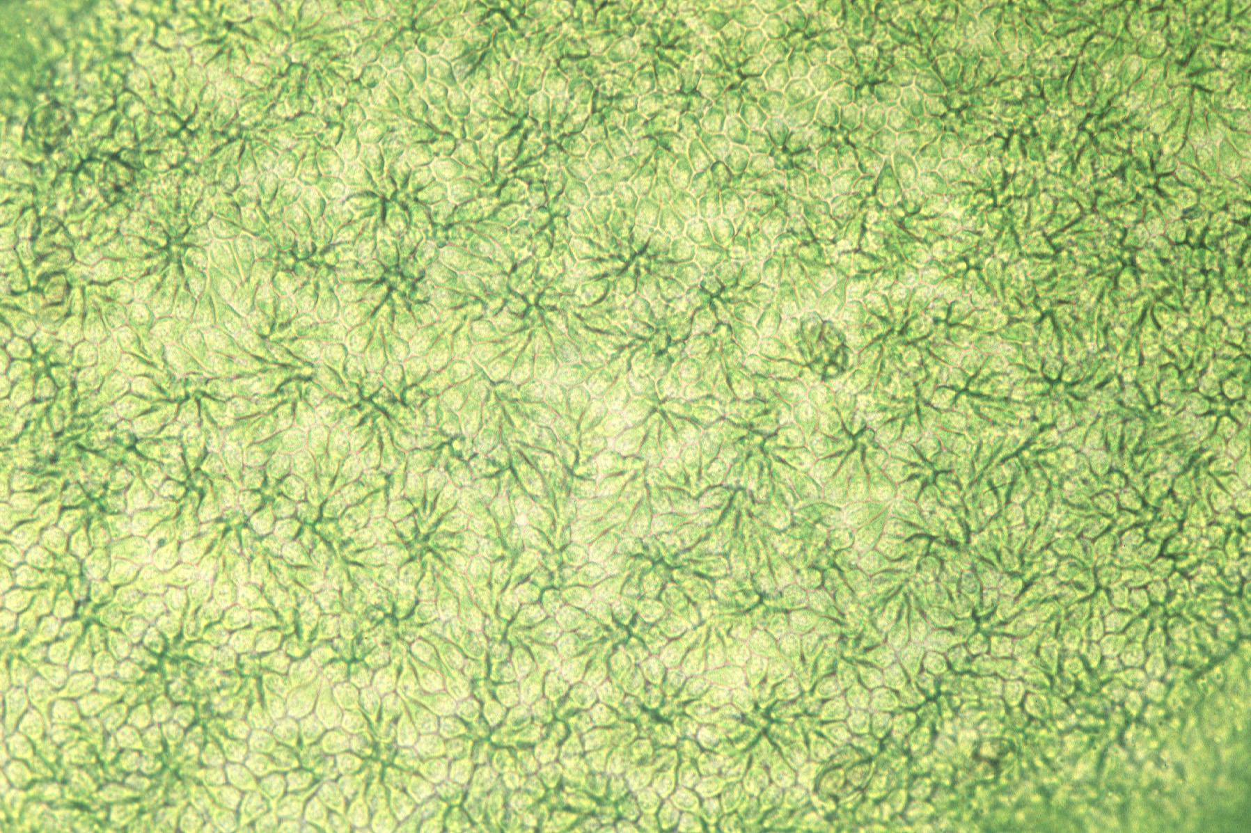 Urospora wormskioldii – M. Lindeberg · Cook Inlet